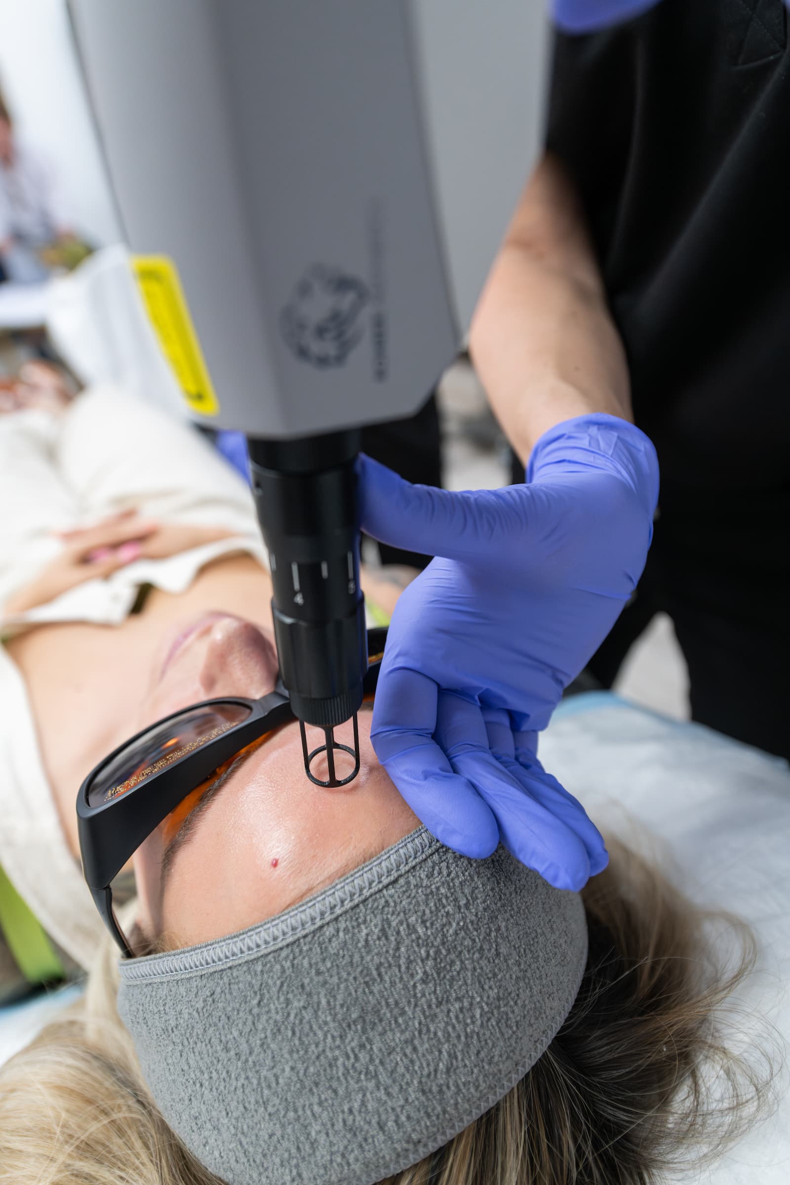 Laser Erbium/Q-Switch in Colorado Springs