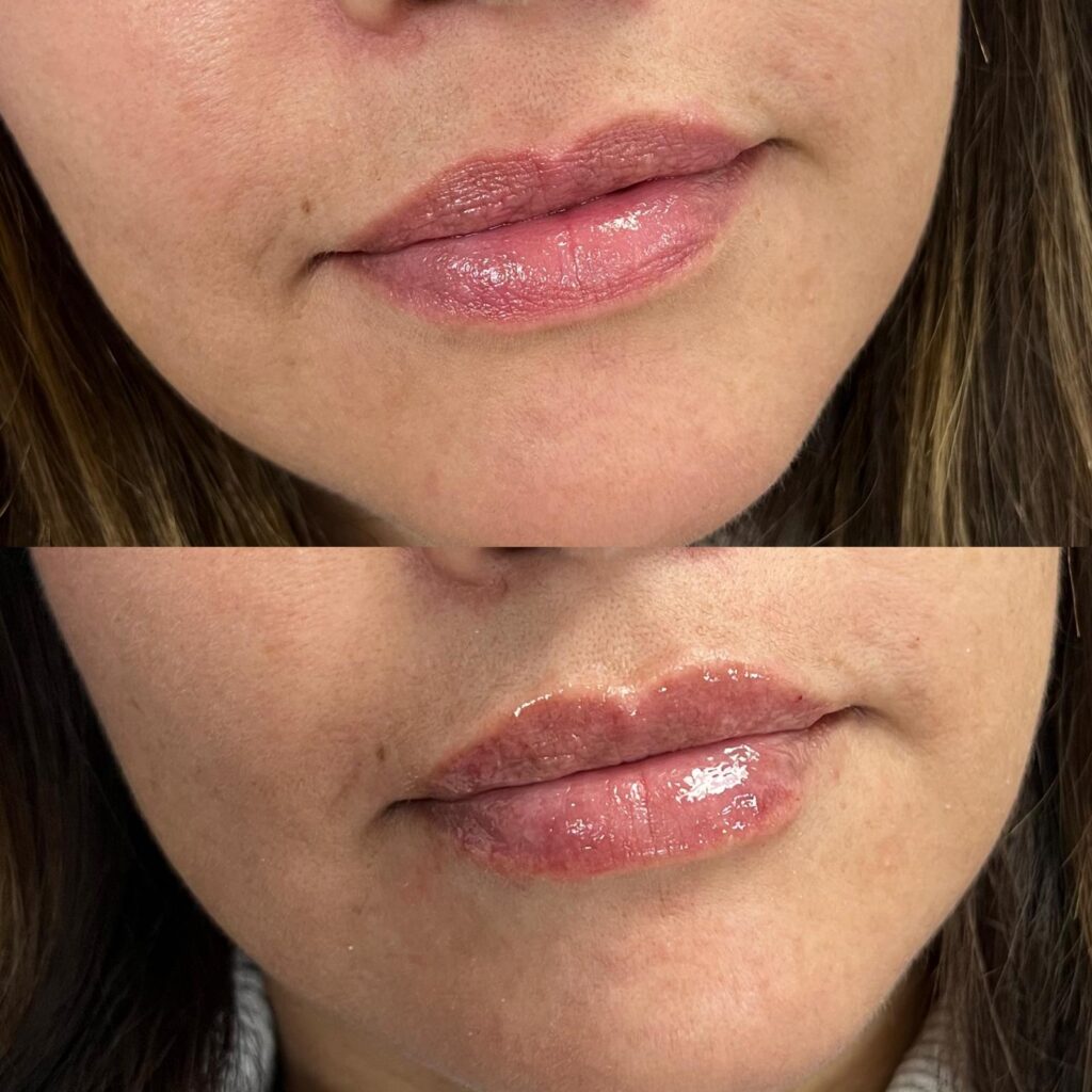 Aspen Elevated Before and After photos