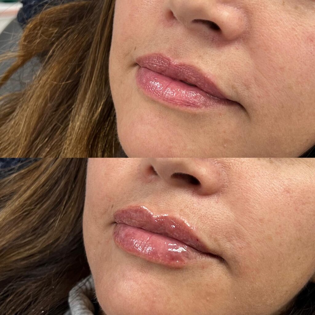 Aspen Elevated Before and After photos
