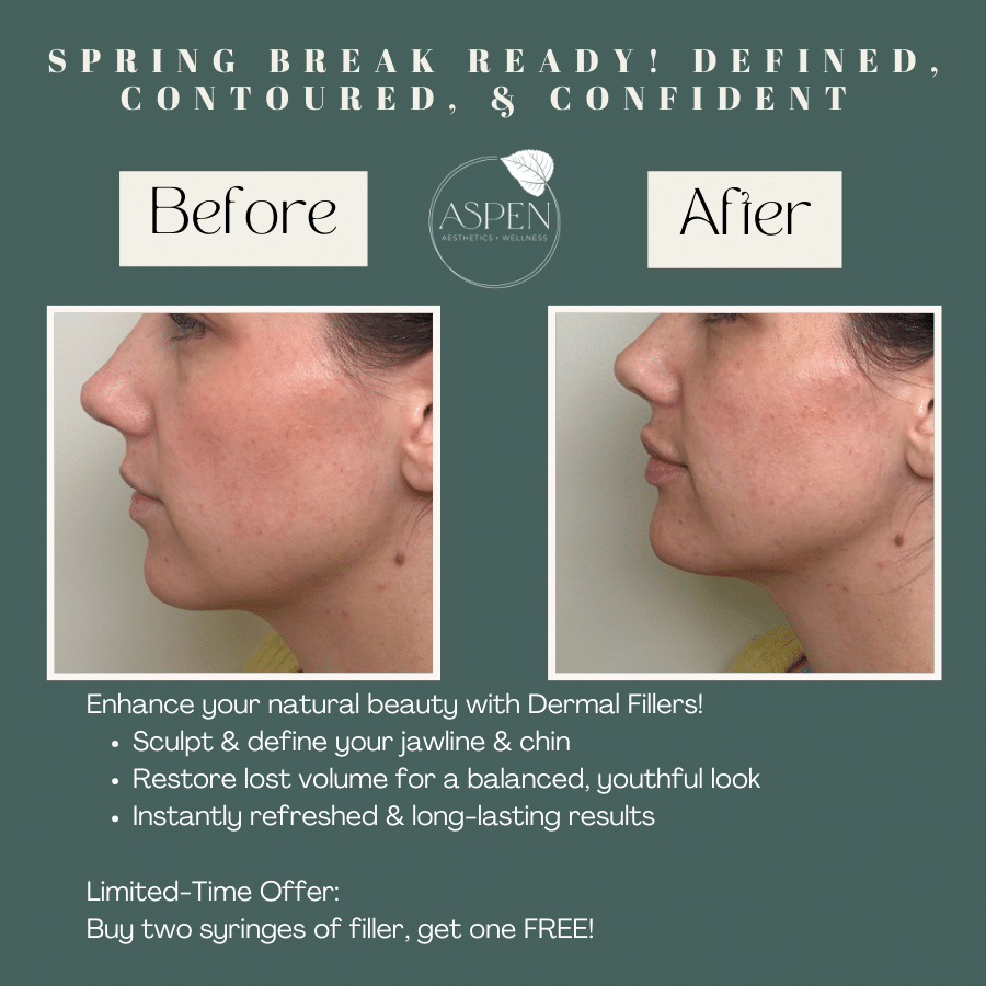 dermal fillers colorado springs