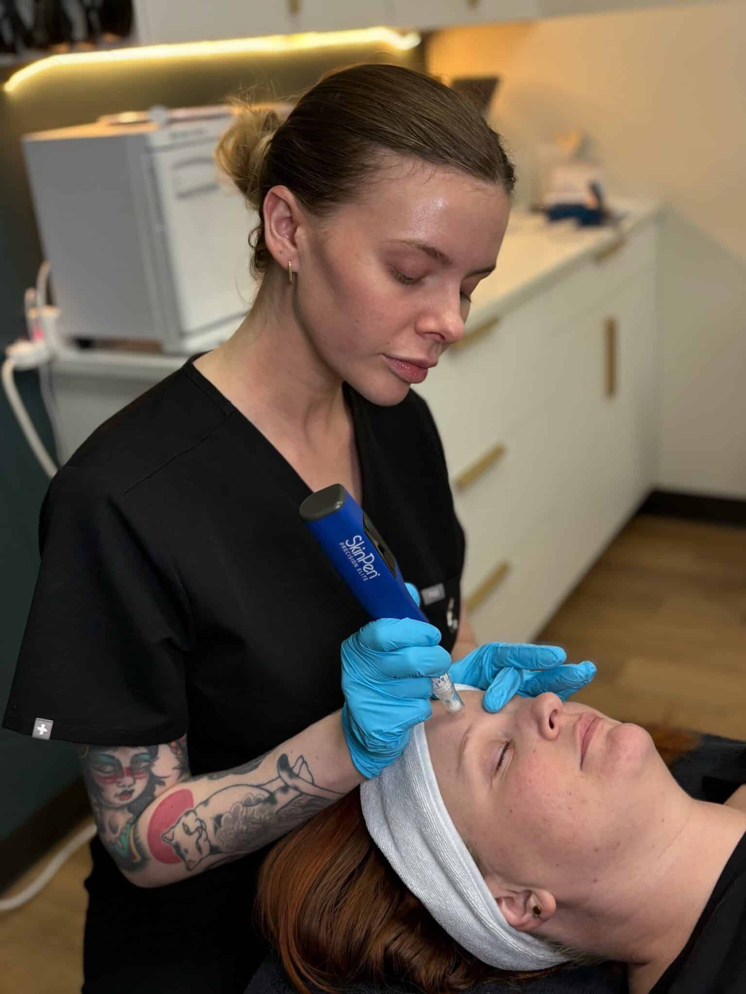 microneedling prp colorado springs