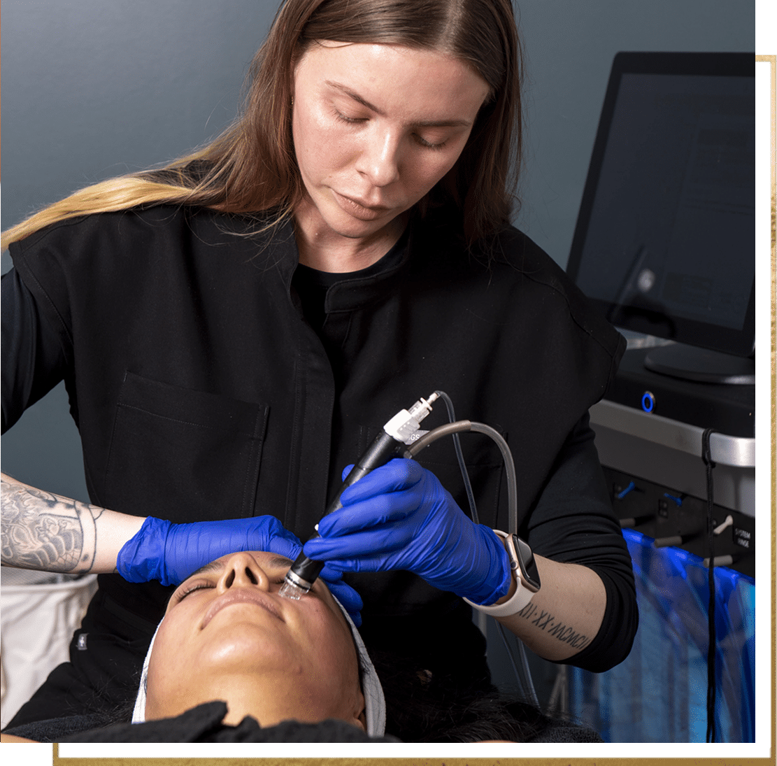 Microneedling PRP and PiXel8 RF microneedling options at Aspen Wellness Colorado Springs
